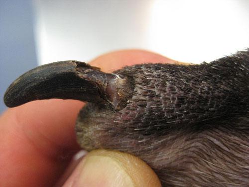 cas-donychodystrophie-lupoide-symetrique4