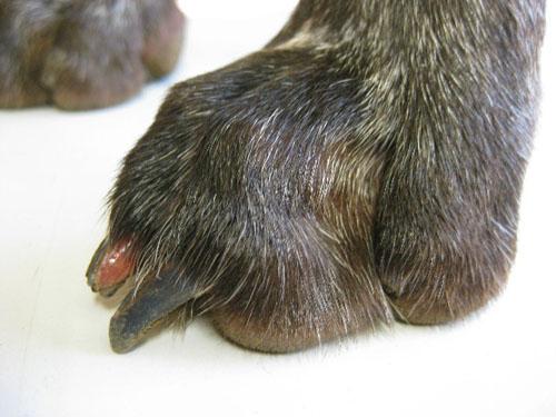 cas-donychodystrophie-lupoide-symetrique5