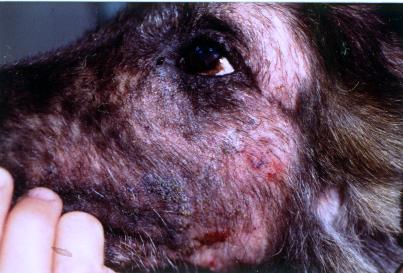 Dermatoses parasitaires