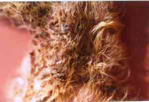 dermatite-malassezia-tumeur-pancreaique4