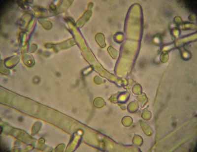 dermatomycose-encolure10