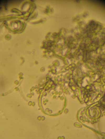 dermatomycose-encolure11