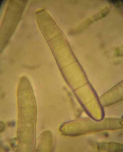 dermatomycose-encolure12