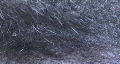 dermatomycose-encolure2