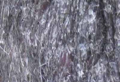 dermatomycose-encolure4
