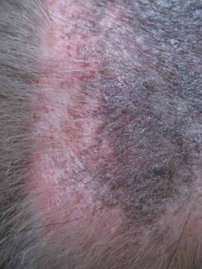 dermatomycose-encolure5