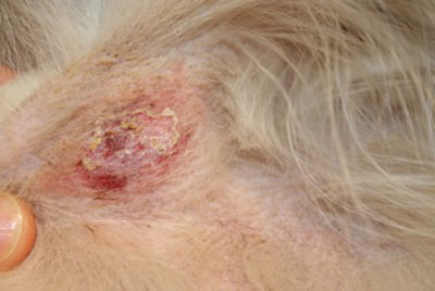 dermatophytose-atypique8-jpeg