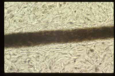 dermatophytose-feline3