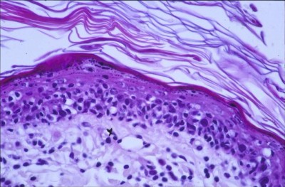 Quel est votre diagnostic ? - Article 9 diagnostic-article-103