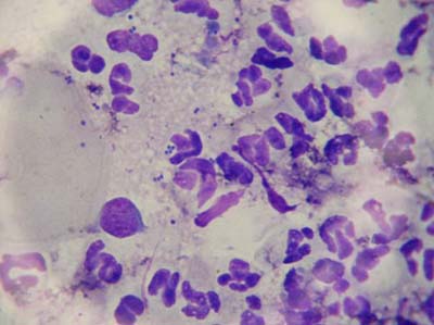Quel est votre diagnostic - Article 13 diagnostic-article-13-3