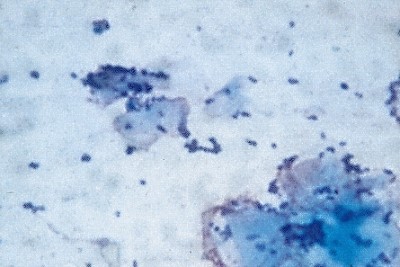 Quel est votre diagnostic - Article 6 diagnostic-article-33