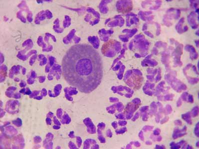 Quel est votre diagnostic ? - Article 12 diagnostic-article-64