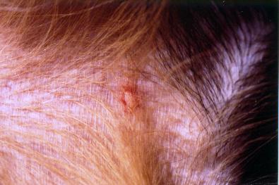 forme-particuliere-de-pemphigus-foliace-chez-jeune-bouvier-bernois2