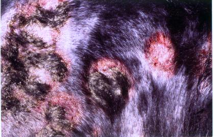 Dermatoses auto-immunes