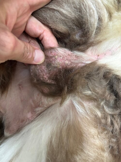 Un Cas de Dermatite Psoriasiforme Lichénoïde Un Cas de Dermatite Psoriasiforme Lichénoïde