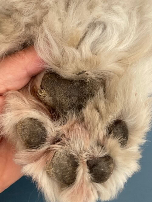 Un Cas de Dermatite Psoriasiforme Lichénoïde Un Cas de Dermatite Psoriasiforme Lichénoïde