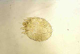 Diagnose parasitaire