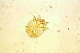 Diagnose parasitaire