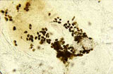 Diagnose parasitaire Diagnose parasitaire