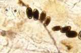 Diagnose parasitaire