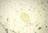 Diagnose parasitaire Diagnose parasitaire