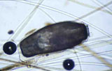 Diagnose parasitaire Diagnose parasitaire