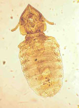 Diagnose parasitaire Diagnose parasitaire
