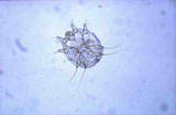 Diagnose parasitaire Diagnose parasitaire