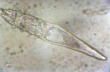 Diagnose parasitaire