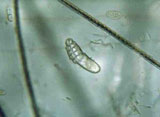 Diagnose parasitaire