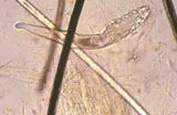 Diagnose parasitaire