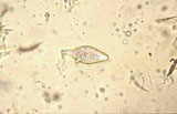 Diagnose parasitaire