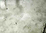 Diagnose parasitaire Diagnose parasitaire