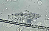 Diagnose parasitaire Diagnose parasitaire