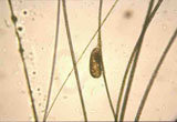 Diagnose parasitaire Diagnose parasitaire