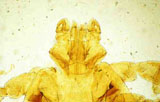 Diagnose parasitaire Diagnose parasitaire