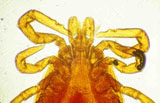 Diagnose parasitaire Diagnose parasitaire
