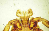 Diagnose parasitaire Diagnose parasitaire