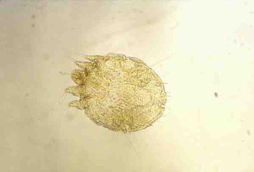 Sarcoptes scabiei adulte femelle Sarcoptes scabiei adulte femelle