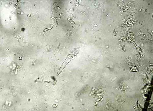 Demodex cati adulte Demodex cati adulte