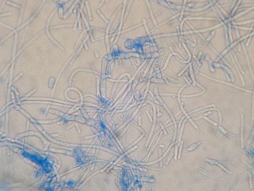 teigne-microsporum-canis-extensive13