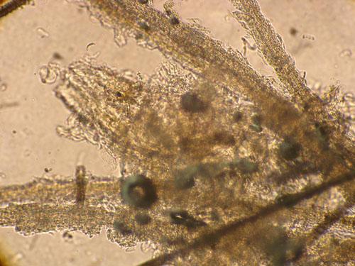 teigne-microsporum-canis-extensive9